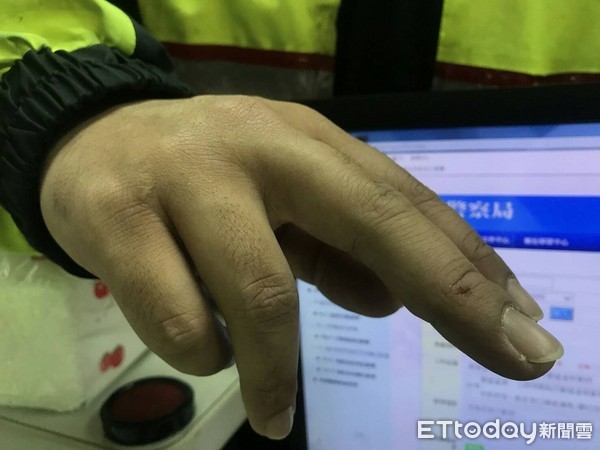 ���쉺���^���ֲ������������