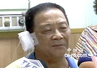 被民進黨籍議員盧同協(xié)砸傷的災(zāi)民。電視截圖