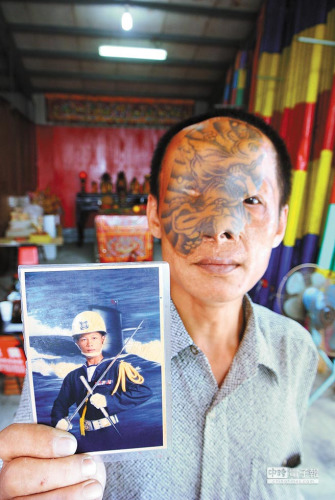 臺男子燒傷臉為救命將大腿刺青移植臉上(圖)