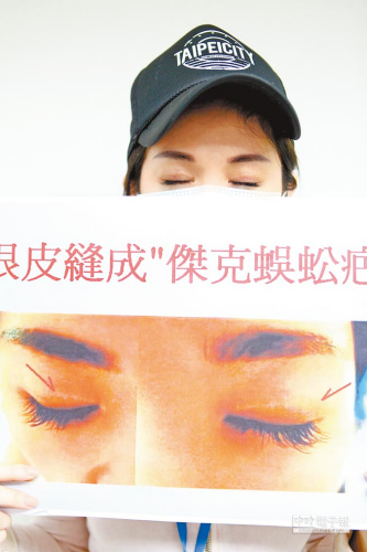 三女子組團(tuán)整形均失敗變蜈蚣疤斜歪鼻大小眼