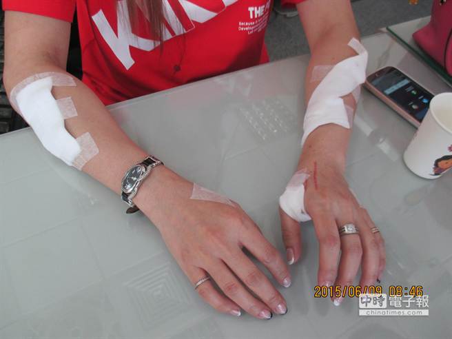 臺灣37歲離婚女為博初中同學關心 竟自殘謊稱遭性侵 臺灣37歲離婚女為博初中同學關心 竟自殘謊稱遭性侵