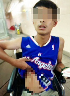 �_�����\�˵����ˏN��2�fԪ���������|ɭ���D��