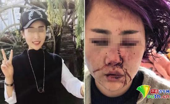 ����Ů��������ǰ��(du��)������