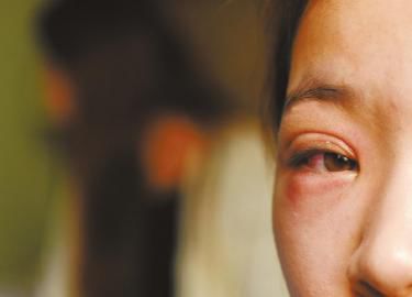 ëë��һֻ�۾��܂��t�[��