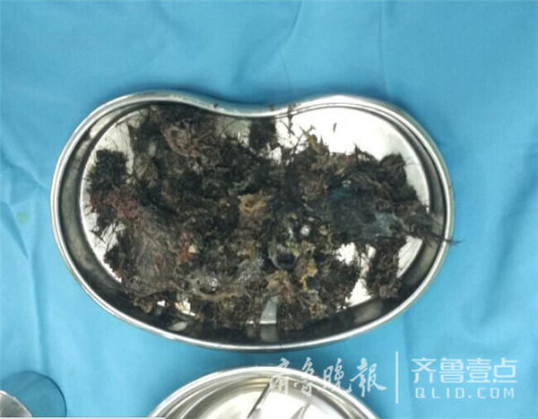 5�qŮͯ��͵���^�l(f��) θ��ȡ������ë�l(f��)�Yʯ