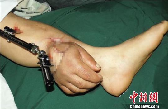 ���Ӕ��֡����B(y��ng)��С�� 30�����ɹ��ƻظ첲