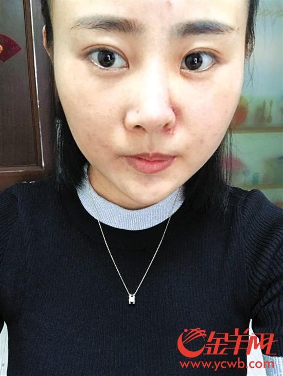 �ܺ��˱���ǰ�󌦱� (�DƬ�ɮ�(d��ng)�����ṩ��