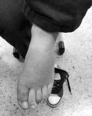 南京遭虐待男童稱因撒謊被打不怪繼母 南京遭虐待男童稱因撒謊被打不怪繼母