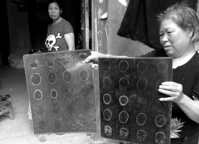 ��Ҋ־ĸ�H������(d��ng)���Ҋ־���H�^�����҂���CTƬ�������A�r(sh��)��(b��o)ӛ�� ����єz